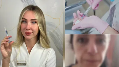 Обезобразени и забравени: Мълчаливият ад на жертвите на "Д-р Гуудз"