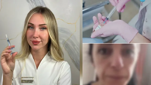 Обезобразени и забравени: Мълчаливият ад на жертвите на "Д-р Гуудз"