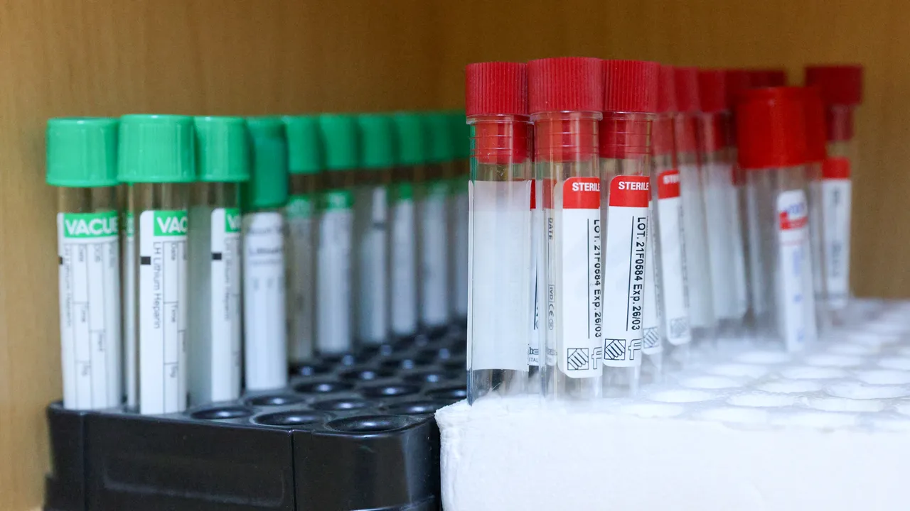 Грип или COVID? Д-р Димитров дава отговорите