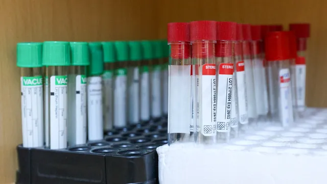 проф. Кантарджиев: Грипната вълна вече е факт