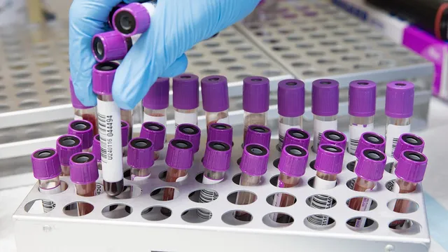 Пускайте водата в хотелската баня преди душ: съвет на експерт след първи случай на легионерска болест за 2026 г.