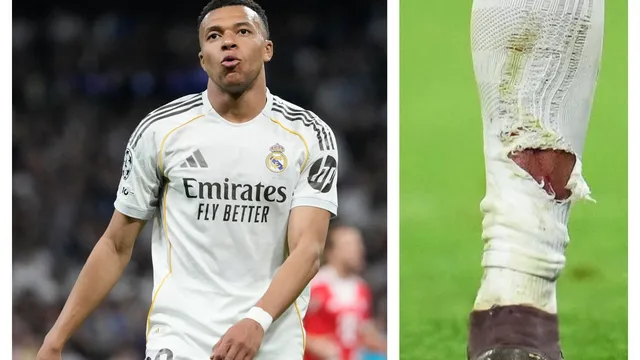 Реал Мадрид избухна: Как това не е червен картон!?