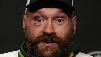 Тайсън Фюри хвърли ръкавицата на Антъни Джошуа