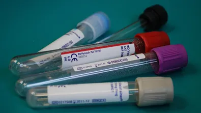 В Пловдив и Бургас откриват нови лаборатории за тестове за алкохол и наркотици